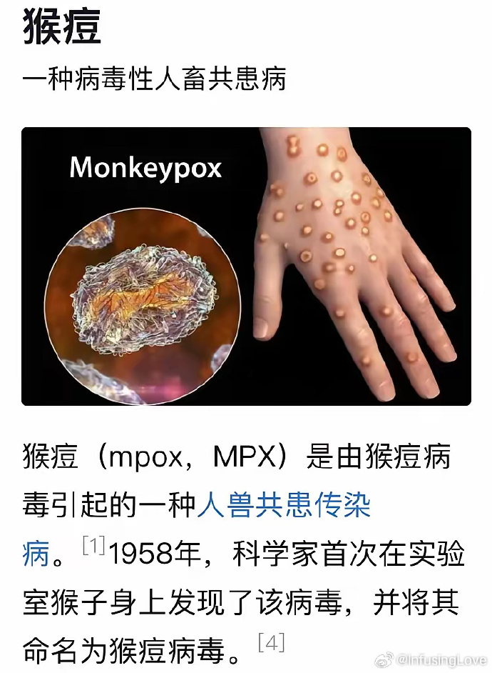 【猴痘病毒是什么原因引起的,猴痘病毒是什么病毒】 【猴痘病毒是什么原因引起的,猴痘病毒是什么病毒】