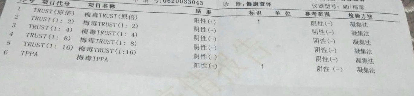 第一项阳性能转阴吗/第一次检查阳性第二次阴性 第一项阳性能转阴吗/第一次检查阳性第二次阴性
