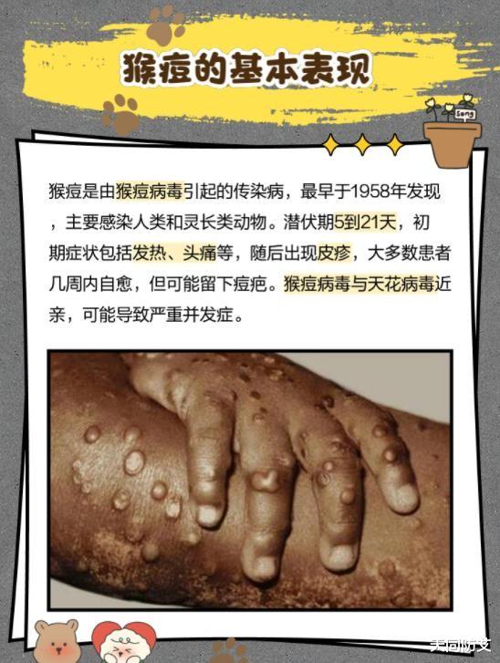 猴痘百度百科/猴疹图片 猴痘百度百科/猴疹图片