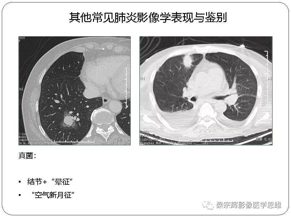 泰安市新冠肺炎最新消息/泰安市新型冠状病毒最新消息 泰安市新冠肺炎最新消息/泰安市新型冠状病毒最新消息